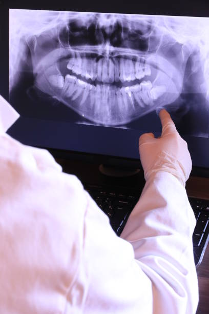 Best Emergency Dental Care for Broken or Chipped Teeth in Fayetteville, NY